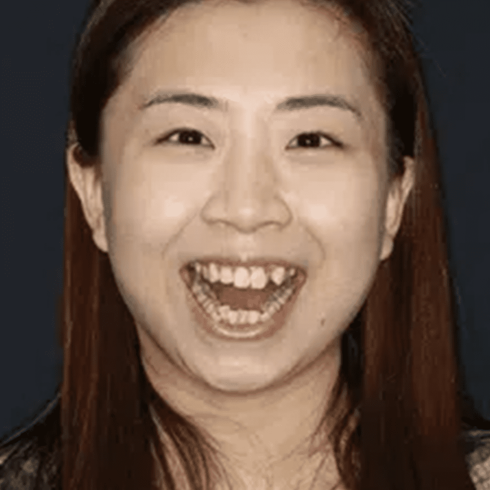 Before cosmetic dentistry treatment in Sydney