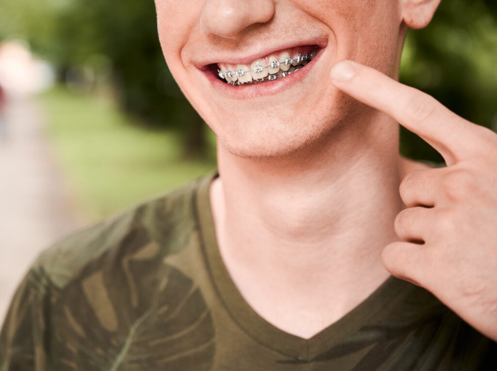 Can Orthodontics Help with Impacted Teeth?