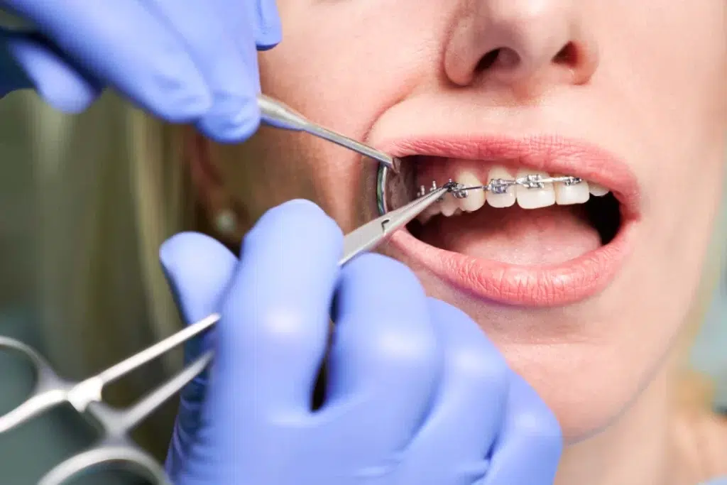 Orthodontist Sydney, Sydney Orthodontics