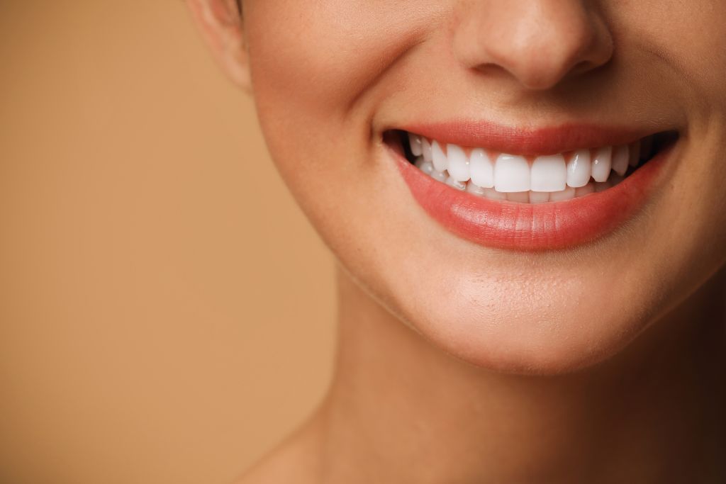 dental porcelain veneers sydney