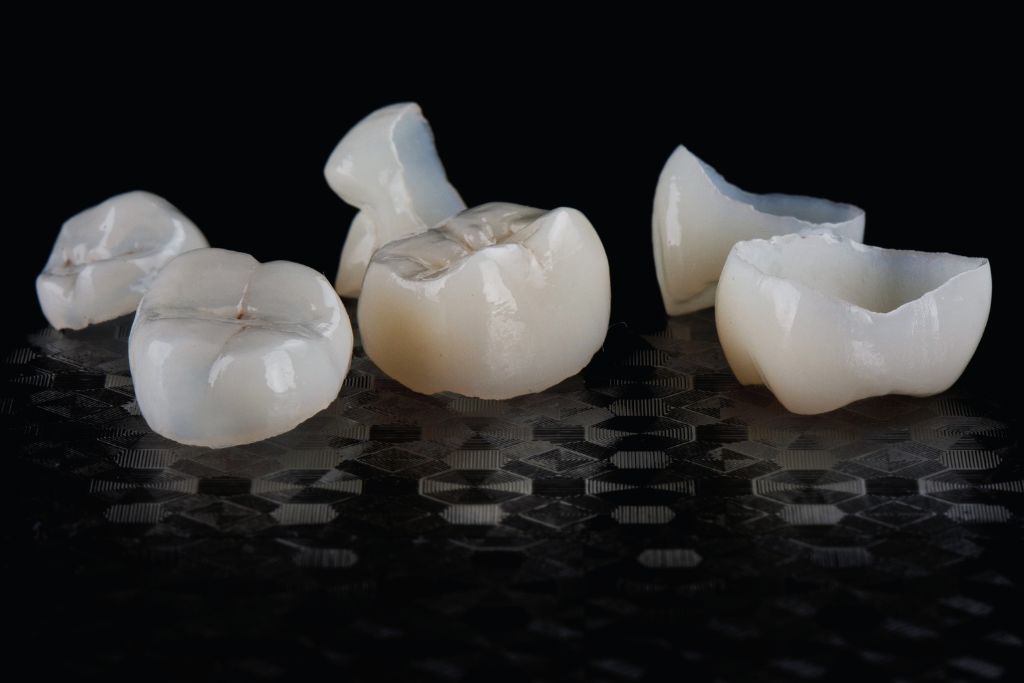 porcelain dental veneers cost less than crowns in sydney